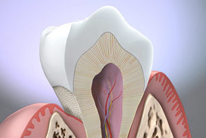 оголение шейки зуба, хирургическое лечение в уфе