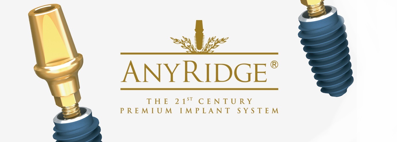 Особенности имплантатов AnyRidge.