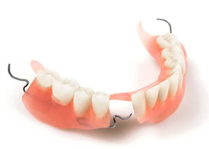 частичный съемный зубной протез